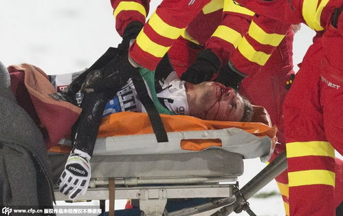 比绍夫斯霍芬天气预报